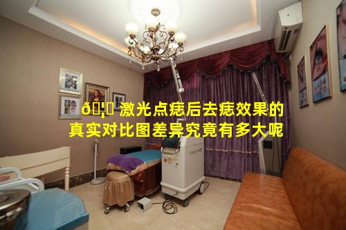 🦈 激光点痣后去痣效果的真实对比图差异究竟有多大呢